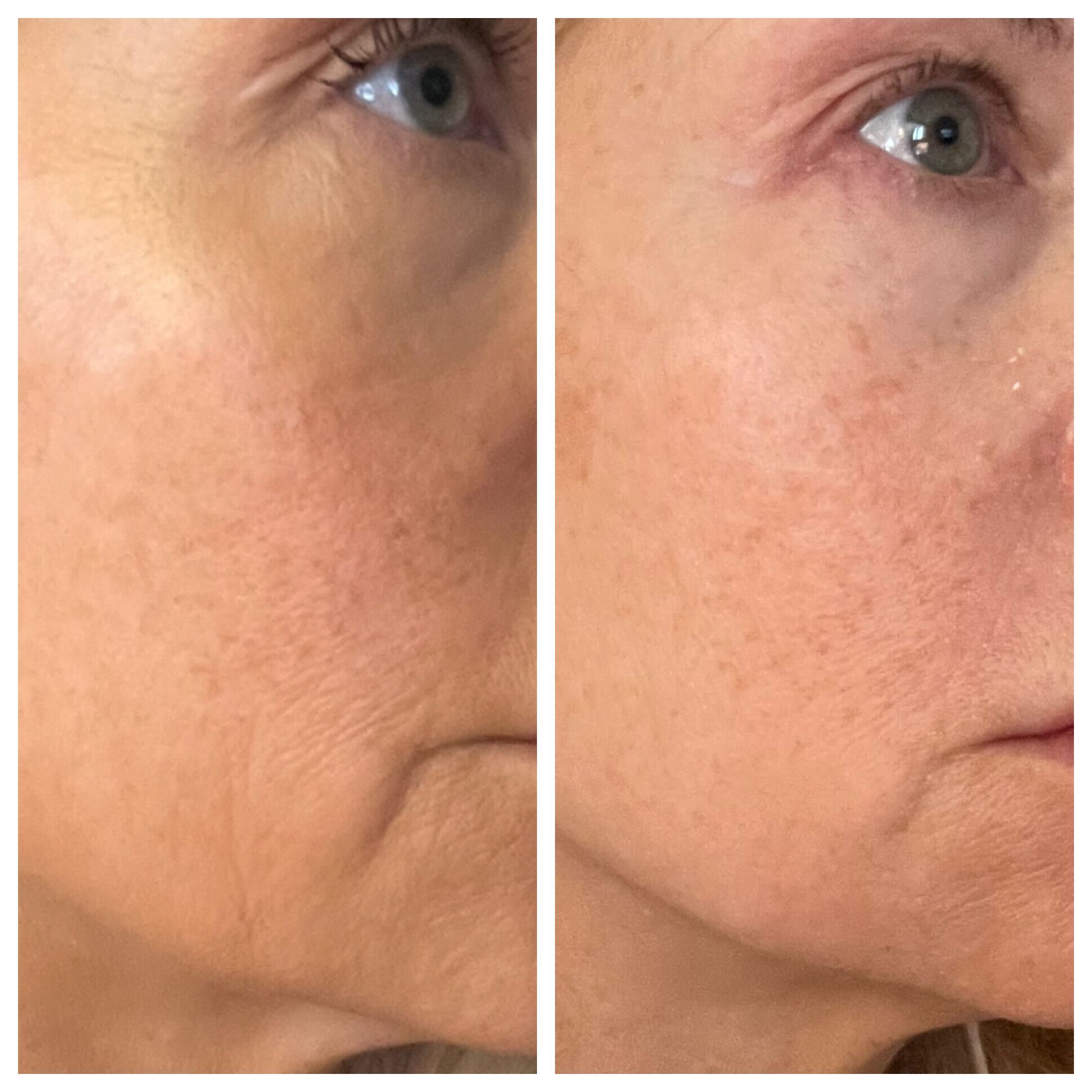 Client Confidence Boost After Treatment
